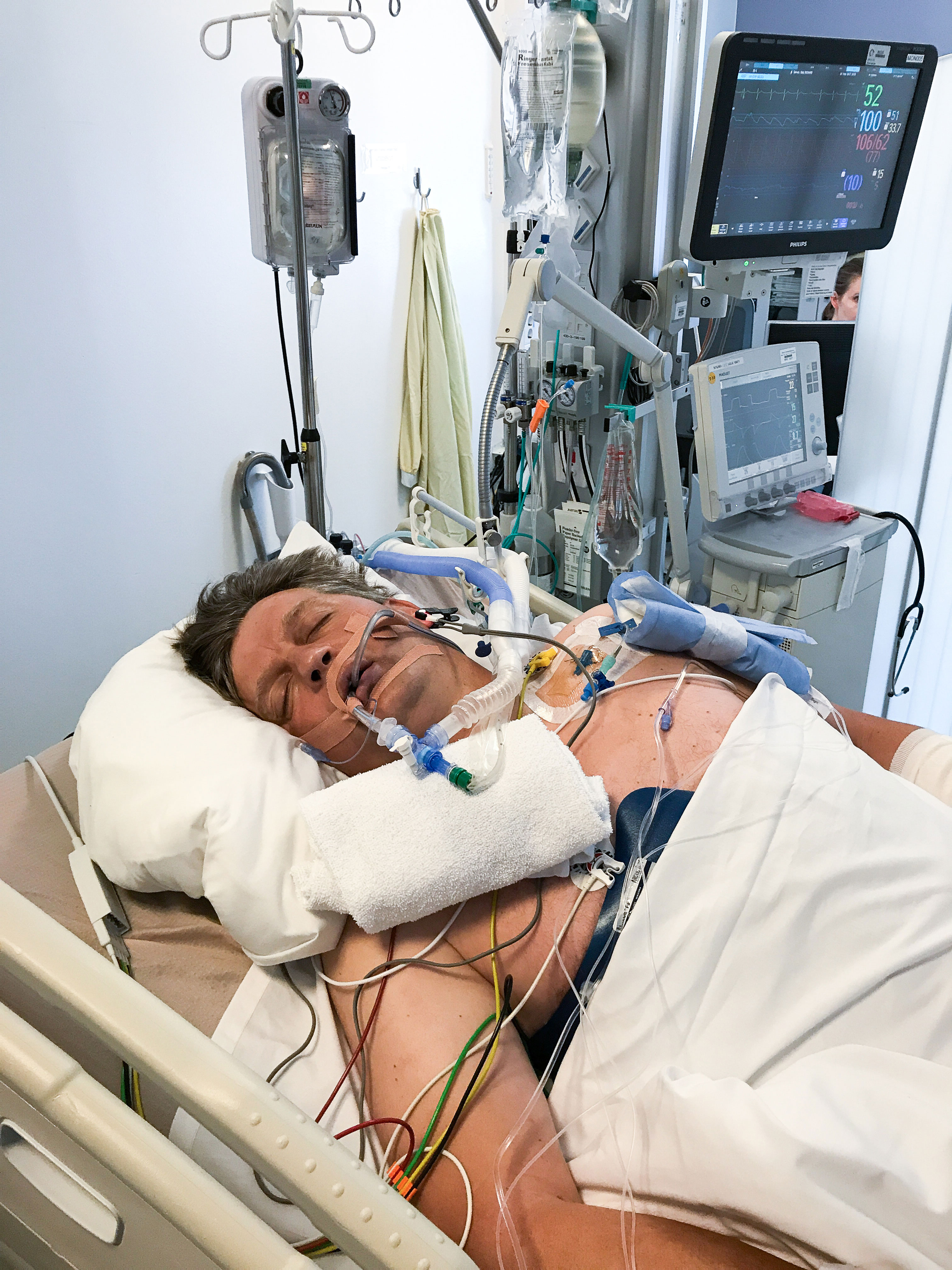 Dag Richard lå i kunstig koma på Ullevål sykehus for å forebygge hjerneskade. Foto: Privat